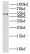 Pseudouridine Synthase 3 antibody, FNab06959, FineTest, Western Blot image 