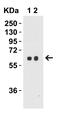 Serine Palmitoyltransferase Long Chain Base Subunit 2 antibody, A05504, Boster Biological Technology, Western Blot image 