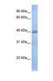 Thioredoxin Domain Containing 15 antibody, NBP1-69614, Novus Biologicals, Western Blot image 