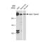 Spectrin Alpha, Erythrocytic 1 antibody, GTX03225, GeneTex, Western Blot image 