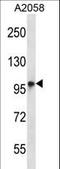 Transmembrane Channel Like 6 antibody, LS-C161946, Lifespan Biosciences, Western Blot image 