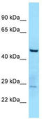 Tubulin Tyrosine Ligase Like 3 antibody, TA343263, Origene, Western Blot image 