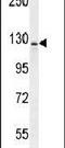 Inhibitor Of Bruton Tyrosine Kinase antibody, PA5-24224, Invitrogen Antibodies, Western Blot image 