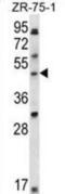 LIM Domain Binding 1 antibody, abx028373, Abbexa, Western Blot image 