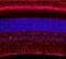 Retinaldehyde-binding protein 1 antibody, GTX15051, GeneTex, Immunohistochemistry frozen image 