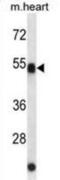 Autophagy Related 4C Cysteine Peptidase antibody, abx025299, Abbexa, Western Blot image 