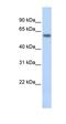 Thyroid Hormone Receptor Beta antibody, orb329952, Biorbyt, Western Blot image 