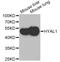 Hyaluronidase 1 antibody, STJ28706, St John