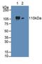 Adenylate Cyclase 3 antibody, LS-C292643, Lifespan Biosciences, Western Blot image 