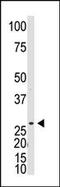 Dickkopf Like Acrosomal Protein 1 antibody, 58-171, ProSci, Western Blot image 