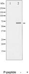 Dihydropyrimidinase Like 2 antibody, MBS002599, MyBioSource, Western Blot image 