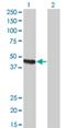 Carboxypeptidase A2 antibody, H00001358-M02, Novus Biologicals, Western Blot image 