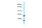 Centrobin, Centriole Duplication And Spindle Assembly Protein antibody, PA5-45298, Invitrogen Antibodies, Western Blot image 