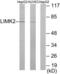 LIM Domain Kinase 2 antibody, LS-C118940, Lifespan Biosciences, Western Blot image 