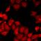 Phospholipase C Beta 1 antibody, LS-C668119, Lifespan Biosciences, Immunofluorescence image 