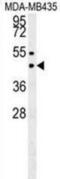 Suppressor Of Variegation 3-9 Homolog 1 antibody, abx026498, Abbexa, Western Blot image 