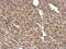 Pyruvate Dehydrogenase E1 Beta Subunit antibody, NBP2-20025, Novus Biologicals, Immunohistochemistry paraffin image 