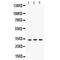 Superoxide Dismutase 3 antibody, LS-C407959, Lifespan Biosciences, Western Blot image 