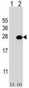 DiGeorge Syndrome Critical Region Gene 6 Like antibody, AP51251PU-N, Origene, Western Blot image 