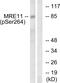 MRE11 Homolog, Double Strand Break Repair Nuclease antibody, PA5-38868, Invitrogen Antibodies, Western Blot image 