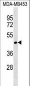 Translocase Of Inner Mitochondrial Membrane 50 antibody, LS-C157198, Lifespan Biosciences, Western Blot image 