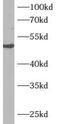 Armadillo Repeat Containing X-Linked 1 antibody, FNab00588, FineTest, Western Blot image 