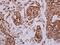 Anterior Gradient 3, Protein Disulphide Isomerase Family Member antibody, GTX108985, GeneTex, Immunohistochemistry paraffin image 