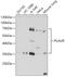 Plasminogen Activator, Urokinase Receptor antibody, GTX64381, GeneTex, Western Blot image 