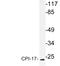 Protein Phosphatase 1 Regulatory Inhibitor Subunit 14A antibody, LS-C177687, Lifespan Biosciences, Western Blot image 