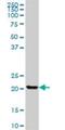 Clathrin Light Chain B antibody, H00001212-B01P, Novus Biologicals, Western Blot image 
