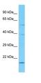 Glutamyl-TRNA Amidotransferase Subunit B antibody, orb327076, Biorbyt, Western Blot image 