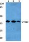 Mitochondrial Transcription Termination Factor 1 antibody, PA5-36984, Invitrogen Antibodies, Western Blot image 