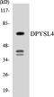 Dihydropyrimidinase Like 4 antibody, LS-C291893, Lifespan Biosciences, Western Blot image 