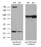 Sperm Associated Antigen 5 antibody, LS-C798785, Lifespan Biosciences, Western Blot image 