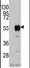 Aldehyde Dehydrogenase 2 Family Member antibody, PA5-11484, Invitrogen Antibodies, Western Blot image 