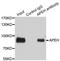 Acylaminoacyl-Peptide Hydrolase antibody, STJ28166, St John