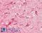 Neurofilament Light antibody, LS-B10376, Lifespan Biosciences, Immunohistochemistry paraffin image 