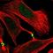 Transmembrane Protein 117 antibody, NBP1-94078, Novus Biologicals, Immunofluorescence image 