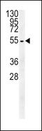 Tubulin Beta 3 Class III antibody, 62-035, ProSci, Western Blot image 