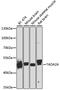 Transcriptional Adaptor 2A antibody, 23-596, ProSci, Western Blot image 