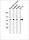 Fibroblast Growth Factor Receptor 4 antibody, MBS9205497, MyBioSource, Western Blot image 