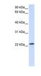 RAB18, Member RAS Oncogene Family antibody, NBP1-58863, Novus Biologicals, Western Blot image 