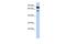 Dpy-19 Like 4 antibody, A16068, Boster Biological Technology, Western Blot image 