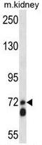 Amyloid-like protein 2 antibody, AP50207PU-N, Origene, Western Blot image 