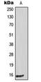 Tumor Protein P53 Inducible Protein 11 antibody, MBS821403, MyBioSource, Western Blot image 