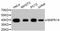 p38 antibody, STJ112728, St John