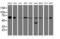 Ubiquinol-Cytochrome C Reductase Core Protein 1 antibody, M06974-1, Boster Biological Technology, Western Blot image 
