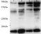 Bone Morphogenetic Protein 7 antibody, ab56023, Abcam, Western Blot image 