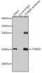 Translocase Of Outer Mitochondrial Membrane 20 antibody, GTX32928, GeneTex, Immunoprecipitation image 