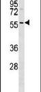 Serine/Threonine Kinase 17a antibody, PA5-14047, Invitrogen Antibodies, Western Blot image 